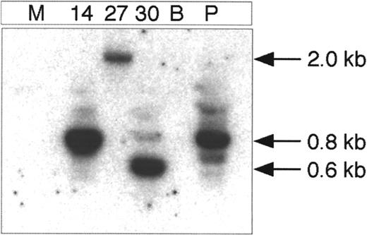 Fig. 6. Integration analysis of the provirus in lentivirally transduced bone marrow cells of primary NOD/SCID recipient mice. / DNA from lentivirally transduced individual visually green CFU-GM colonies from 3 different mice was digested with BamHI, self-ligated at a low DNA concentration, and used as template in the PCR reaction. GFP and LTR primer sets (GFP 195R and LTR 469) were amplified. The colonies are numbered 14, 27, and 30. The figure shows the membrane of the inverse PCR reaction hybridized with the LTR specific oligo probe. The minimal size of the inverse PCR product is approximately 450 bp. M indicates mock-transduced control colony; B, blank; and P, positive control. The P colony is derived from lentivirally transduced ES cells that are known to contain integrated PGK-GFP vector as determined by Southern blot analysis.33