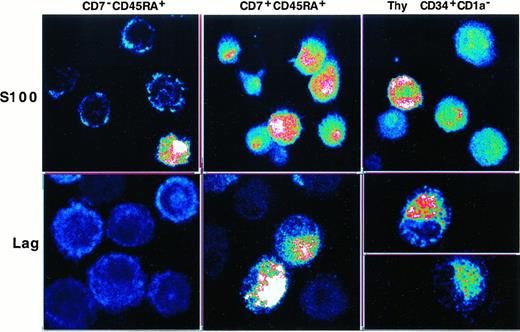 Fig. 5. Confocal fluorescence microscopy analysis of S100 and Lag expression by immature DCs differentiated from SP (CD7−45RA+), DP (CD7+45RA+), or CD34+CD1a− thymic HPCs. / SP HPCs were cultured for 8 days under the standard condition, IL-4 being added from day 5 onward before DCs were sorted, based on high CD1a expression, and cytospun; DP and thymic HPCs were cultured and processed under the same conditions but without preliminary sorting (CD1ahi DC more than or equal to 90% of day 8 cells). Images at 0.25 mm pixel size were obtained at × 40 magnification, 1.0 numerical aperture, and visualized in pseudocolor. Results are representative of 2 of 6 experiments.