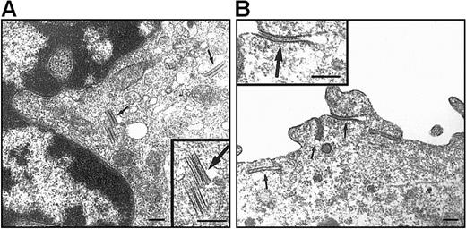 Fig. 6. EM examination of DCs originating from DP and SP HPCs. / DCs were sorted as indicated in the legend of Figure 5, from 9 day cultures under the standard condition with TGF-β1 added from culture day 0. Both DP HPC-derived (A) and SP HPC-derived (B) DCs present BGs (arrows). Note that typical cytoplasmic rod-shaped BGs, located at the vicinity of the Golgi apparatus, are present in DP HPC-derived DCs; in SP HPC-derived DC BGs are predominantly formed by a sandwiching process of the plasma membrane. Bars represent 200 nm. Data are from 1 of 2 experiments.