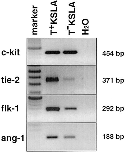 Fig. 2. RT-PCR on Tie-2–positive and –negative KSLA cells. / PCRs for c-kit, tie-2, flk-1, andang-1 genes were performed on normalized cDNA from these cells. One PCR contained cDNA equivalent to 500 to 1000 cells by calculation.