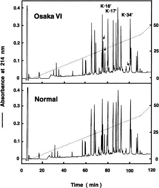 Fig. 3. HPLC profile of lysylendopeptidase digests of Bβ chain. / The lysylendopeptidase digests of Pe-Bβ chains derived from normal fibrinogen and fibrinogen Osaka VI were injected onto a TKS GEL ODS-80 column (4.6 × 150 mm), and the peptides were eluted with a linear gradient from 0% to 40% acetonitrile in 100 minutes. Three Osaka VI peaks, K16, K17, and K34, and normal K16 and K17 were collected and subjected to N-terminal amino acid sequence analysis.