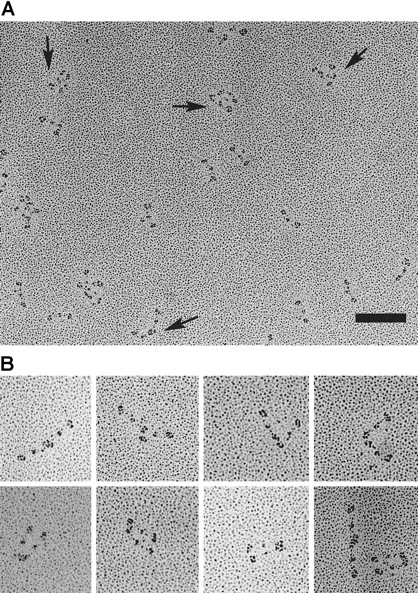 Fig. 4. Electron microscopy of individual rotary-shadowed molecules of fibrinogen Osaka VI. / (A) Field of the patient's fibrinogen showing 3 species of fibrinogen molecules, ie, simple trinodular molecules, end-linked dimers, and end-linked bilayer dimers (arrows), and aggregates. Bar, 100 nm. (B) Gallery of typical end-linked dimers.