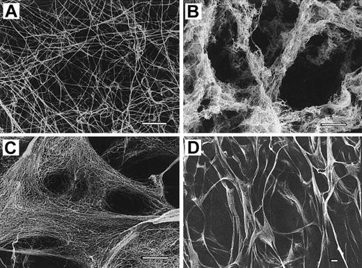 Fig. 5. SEM-images of fibrin clots. / (A) Normal fibrin clots as control. (B) Clot formed from the patient's fibrinogen after 45 minutes of incubation with thrombin showing thin fibers forming a secondary network of spongelike structure. (C,D) Clots formed after 17 hours of incubation with thrombin, showing large pores bounded by smaller secondary, highly branched lacelike networks. Bar, 2 μm.