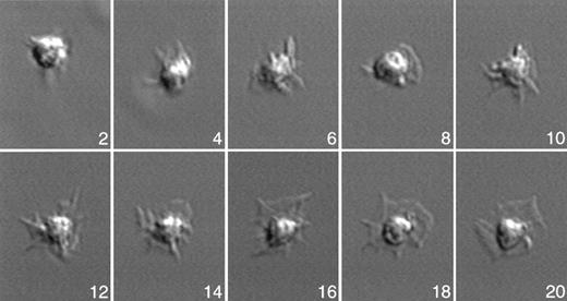 Fig. 1. Morphologic changes occurring in human platelets activated on CRP-coated surfaces. / Representative morphology of a single human platelet activated on a CRP-coated surface. Platelets were allowed to adhere to CRP-coated glass coverslips. Attachment and activation were followed by video microscopy. Images shown are captured at 2-minute intervals after the initial adhesion and activation reaction. Major morphologic changes occur in CRP-activated platelets: adherence effects a rounding of the discoid cell; filopodia are protruded and retracted; filopodia form and rotate; and spaces between filopodia are filled by lamellipodia protrusion. Time is indicated in minutes.
