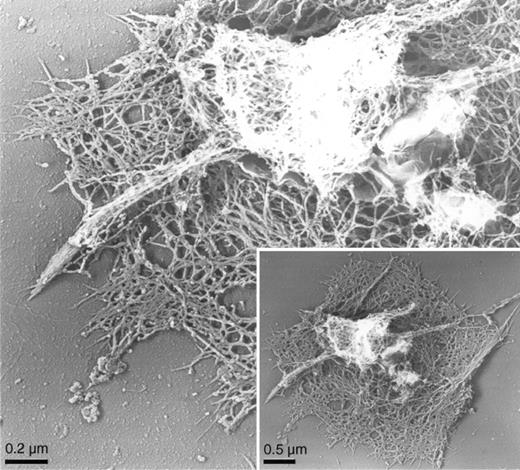 Fig. 2. Actin cytoskeleton of human platelets activated on CRP-coated surfaces. / Cytoskeleton of a human platelet activated on a CRP-coated coverslip surface by electron microscopy. Human platelets were activated on a CRP-coated coverslip surface. Cells were permeabilized with Triton X-100 in PHEM buffer, rapidly frozen, freeze-dried, and metal-coated. Cytoskeletons have prominent central regions from which motile filopodia extend.