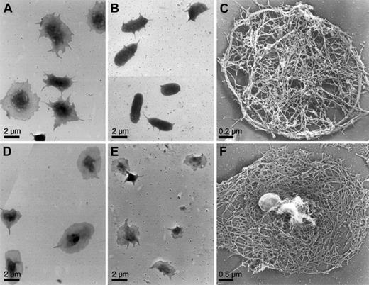 Fig. 3. Surface topology and cytoskeleton of activated mouse platelets. / Mouse platelets were examined for shape change by electron microscopy. WT (A) and SLP-76–deficient (B, C) platelets were activated on a CRP-coated coverslip surface, as in Figure 2. WT (D) and SLP-76–deficient (E, F) platelets were attached to coverslips and activated with 1 U/mL thrombin. Cells were either fixed (A, B, D, E) or permeabilized with Triton X-100 in PHEM buffer (C, F), rapidly frozen, freeze-dried, and metal-coated. SLP-76–deficient platelets exposed to CRP retain their disc shapes, though they grow a small number of short filopodia. The cytoskeleton is similar to that of the normal resting mouse platelet cytoskeleton. SLP-76–deficient platelets activated with thrombin spread normally on the surface. The cytoskeleton has rearranged from the resting form and has a cortex composed of short filaments in an orthogonal network.