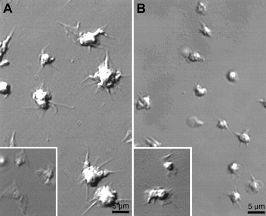 Fig. 5. Absence of lamellae in human platelets preincubated with wortmannin or in gelsolin-deficient mouse platelets. / Platelets stimulated as in Figure 1 were examined for shape change by video microscopy. (A) Effect of 50 nmol/L wortmannin preincubated for 15 minutes on the shape change of human platelets exposed to a CRP-coated surface. (Inset) Shape change of human platelet on CRP-coated surface in the absence of wortmannin. (B) Gelsolin-deficient mouse platelets activated on a CRP-coated surface. (Inset) Mouse WT platelets on a CRP-coated surface. Images were taken after 15 minutes of activation. Results shown are representative of 3 experiments.