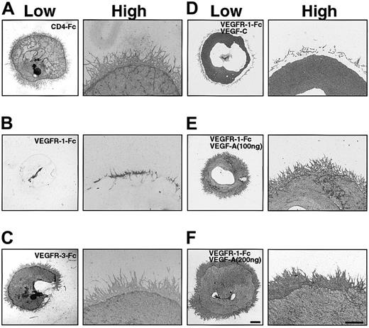 Fig. 4. VEGFR-1–Fc inhibits vascular bed and vascular network formation. / Effects of chimeric proteins containing the extracellular domain of VEGFR-1 or VEGFR-3 in the OP9 coculturing system. Chimeric proteins (20 μg/mL) of the extracellular domain of VEGFR-1 and VEGFR-3 fused to the Fc of human Ig (VEGFR-1–Fc and VEGFR-3–Fc) were added to explant cultures. After 14 days, explants and OP9 cells were stained with the anti-CD31 antibody. CD4-Fc (20 μg/mL) was added as a control (A). Formation of vascular beds and networks was suppressed by 20 μg/mL VEGFR-1–Fc (B) but not by 20 μg/mL VEGFR-3–Fc (C). Addition of VEGF-C (100 ng/mL) rescued only the vascular bed formation of P-Sp explant suppressed by VEGFR-1–Fc (D). Addition of VEGF-A (100 ng/mL) (E) and (200 ng/mL) (F) rescued both vascular beds and network formation of P-Sp explants in the presence of VEGFR-1–Fc. Scale bar indicates 1 mm (low), 0.5 mm (high).