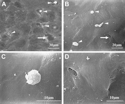Fig. 1. Morphology of PMNs at different stages of transendothelial migration. / PMNs can be identified under either phase-contrast (A) or scanning electron microscopy (B-D). (A) and (B) show several transmigrating PMNs (arrowheads) and a transmigrated PMN (arrow). Transmigrating PMNs are characterized by both clearly visible cell bodies and extended protrusions; the latter are visible under phase-contrast optics (A), but not under scanning electron microscopy (B,C). A transmigrated PMN is almost invisible from the top but appeared as a slightly raised area (B,D).
