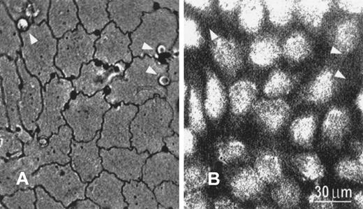 Fig. 2. Silver-stained image and corresponding fluorescent image showing transmigrating PMNs. / (A) Transmigrating PMNs preferentially locate near tricellular corners, as shown in silver-stained micrograph viewed under bright-field optics. The endothelial borders as well as the locations of PMNs (arrowheads) are clearly visible under these conditions. (B) The fluorescence image (380 nm) shows the location of fura-2–stained endothelial cells. Because neither unstained PMNs nor the EC boundary is visible under fluorescence optics, their locations are identified by direct comparison between (A) and (B). Bar equals 30 μm.