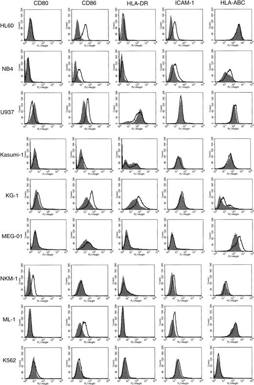 Fig. 1. Expression of CD80, CD86, HLA-DR, ICAM-1, and HLA-ABC in AML cell lines incubated in the presence or absence of SB. / The 9 AML cell lines indicated were incubated with or without SB for 48 hours. HL60 cells were treated with 0.7 mmol/L SB, and all other cells were treated with 0.5 mmol/L SB. The cells were then stained with FITC-conjugated antibodies and analyzed by flow cytometry. Histograms represent the log of fluorescence (horizontal axis) versus the relative cell number (vertical axis). Closed histograms (in black) represent medium-treated cells. Open histograms represent SB-treated cells.