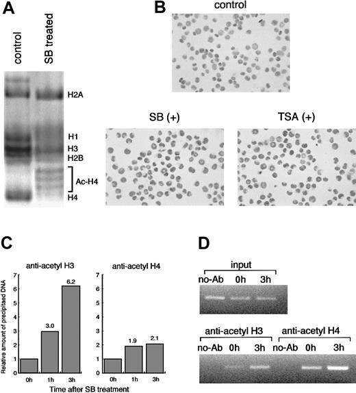 Fig. 3. Histone acetylation by HDACIs in HL60 cells. / (A) HL60 cells were incubated with or without 1.0 mmol/L SB for 6 hours. Each histone fraction was extracted and analyzed on an AUT gel. The gel was stained with Coomassie blue. (B) Histone hyperacetylation by HDACIs was detected in situ using antiacetylated histone H4 antibody. HL60 cells were incubated for 3 hours with either 1.0 mmol/L SB or 100 ng/mL TSA and subjected to immunostaining. In comparison with the control, almost all the cells were stained positively after 3 hours of treatment with both SB and TSA. (C) Soluble chromatin preparations from cell cultures treated with or without SB were immunoprecipitated with the antibody against acetylated histone H3 or H4. Precipitated DNA was quantitated by real-time PCR using SYBR Green Master Mix. On the other hand, aliquots of chromatin solution were directly subjected to DNA extraction followed by real-time PCR, and these were used as input DNA. The ratio of the DNA amount at the indicated time relative to the corresponding input DNA amount was calculated. Finally, the relative amount of each precipitated DNA normalized by input DNA was shown. (D) The PCR products with 27 cycles of conventional PCR using the same primers and DNA template were visualized with ethidium bromide staining. No-Ab indicates that antibodies were not added for ChIP.