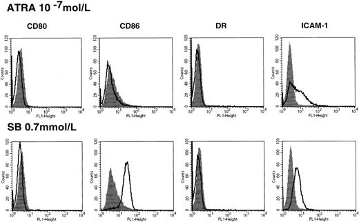 Fig. 4. Costimulatory/adhesion molecules in HL60 cells treated with ATRA. / Cells were incubated in the presence or absence of 10−7mol/L ATRA for 48 hours followed by flow cytometry (upper panel). The results of treatment with 0.7 mmol/L SB were shown for comparison (lower panel). Closed histograms (in black) represent medium-treated cells, whereas open histograms represent ATRA- or SB-treated cells.