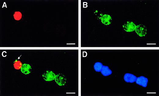 Fig. 3. Identification of immature 5-LO+/CD34dim cells in highly purified freshly prepared HPCs. / Fresh HPCs were isolated to high purity, and fluorescence immunohistochemistry was performed as described in “Materials and methods” using (A) anti–5-LO antiserum, 1550 (red, Cy3), (B) CD34 (green, Cy2), (C) merge of A and B, and (D) DNA stain Hoechst 33258 on an identical field. The arrow in panel C indicates patches of CD34 antigen in a single 5-LO+/CD34dim immature leukocyte close to 3 other 5-LO−/CD34+ HPCs. Bars indicate 10 μm.