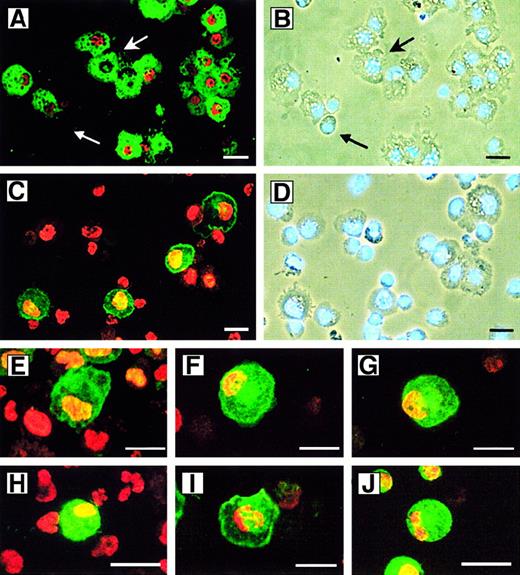 Fig. 4. Heterogeneity of 5-LO+ leukocytes derived from CD34+ HPCs. / HPCs were maintained in culture for 15 days as described in Figure 2 in standard medium (panels A-D, F, I, and J) or standard medium plus TGF-β–1 (panels E, G, and H). Cytospins were stained with antisera as described in “Materials and methods”; 5-LO throughout Cy3 red, marker antisera throughout Cy2 green. (A) HLA-DR/5-LO, identical phase contrast field but stained with (B) DNA stain Hoechst 33258. Upper arrow indicates an HLA-DR+/5-LO− cell; lower arrow indicates an immature HLA-DR−/5-LO−cell. (C) CD1a/5-LO and identical phase contrast field but stained with (D) DNA stain Hoechst 33258, (E) CD40/5-LO, (F) CD83/5-LO, (G) Lag antigen/5-LO, (H) eosinophil peroxidase/5-LO, (I) CD14/5-LO, and (J) mannose receptor/5-LO. Bars indicate 20 μm.