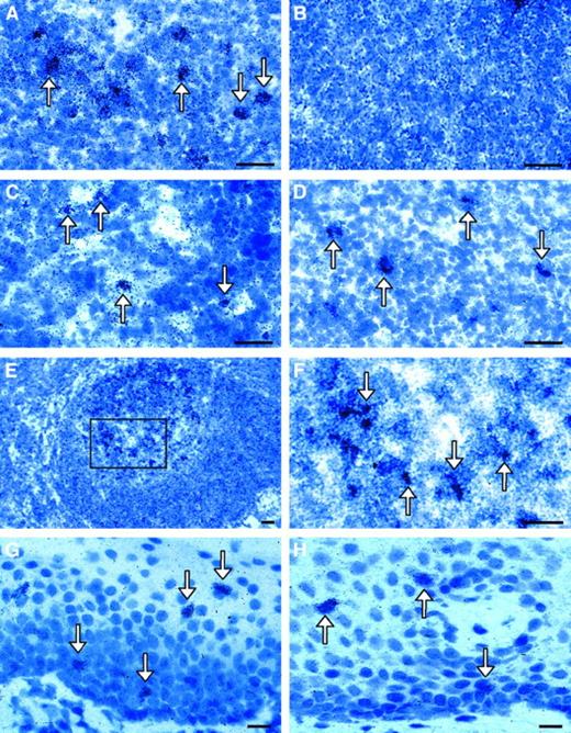 Fig. 7. ISH of 5-LO and FLAP mRNA analyses in human LNs and mucosa of the Waldeyer tonsillar ring. / Bright fields of the (A) paracortical area of LN 5-LO antisense or (B) paracortical area of LN sense; (C) central paracortical area 5-LO antisense; (D) paracortical area FLAP antisense; (E) LN GC 5-LO antisense; (F) same as panel E, but with a higher magnification of inset; (G) mucosa overlying the Waldeyer tonsillar ring 5-LO antisense; or (H) mucosa overlying the Waldeyer tonsillar ring FLAP antisense. There were no specific ISH signals observed for 5-LO sense (panel B) or FLAP sense probes (data not shown). The arrows indicate 5-LO or FLAP mRNA+ cells. Bars indicate 20 μm.