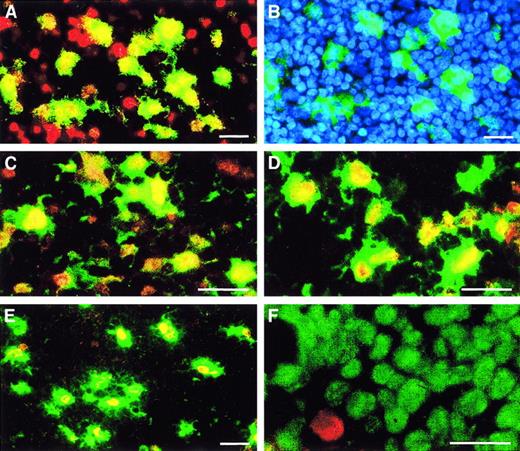 Fig. 8. Immunohistochemistry of LNs localizes 5-LO protein to nuclei of CD1a+- and CD83+-expressing DCs in the paracortex and to CD68+ cells in GCs. / LNs were prepared as described in “Materials and methods,” then double-fluorescence immunohistochemistry was performed as described in Figure 4 (ie, 5-LO throughout Cy3 red, marker antisera throughout Cy2 green) and (A) stained for CD1a/5-LO in the peripheral paracortex, (B) CD1a and DNA stain Hoechst 33258 of the identical field as in panel A, (C) CD83/5-LO in the peripheral paracortex, (D) HLA-DR/5-LO in the peripheral paracortex, (E) CD68/5-LO in LN GC, and (F) Ki67/5-LO in LN GC. Bars indicate 25 μm.
