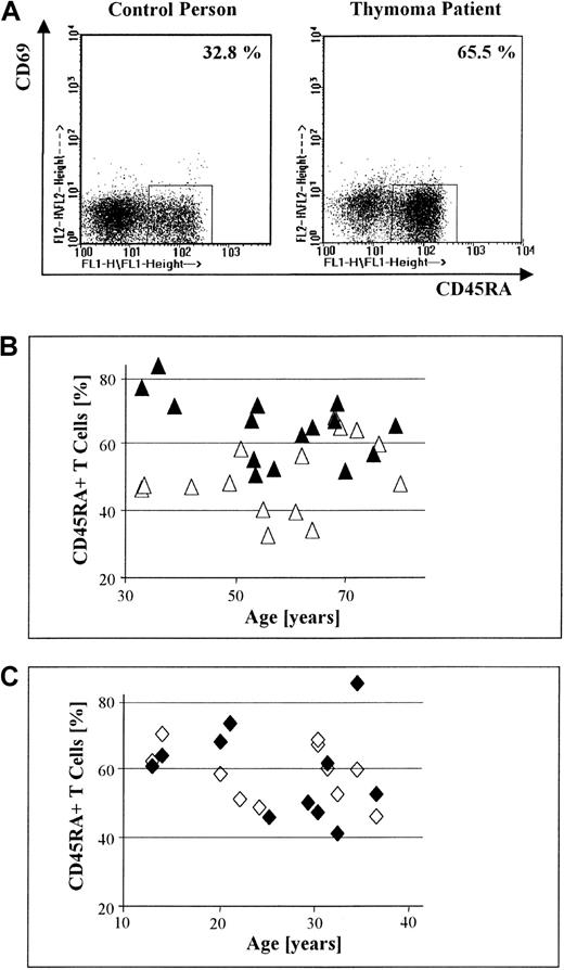 Fig. 1. Significant increase in the percentage of peripheral CD45RA+ T cells in patients with thymoma compared with nonthymoma patients. / (A) Dot-plot displays of 3-color FACS-based analyses of CD69 and CD45RA expression by PBL, gated on CD3+ T cells, in a control versus a thymoma patient (both men, 64 years old). The proportion of circulating CD45RA+CD69− T cells is increased in the thymoma patient compared with the healthy control. (B) The percentage of circulating CD45RA+ T cells in 15 patients with thymoma (▴) is significantly higher than the percentage of circulating CD45RA+ T cells in sex- and age-matched healthy controls (▵; P = .01). (C) There is no significant difference in the percentage of circulating CD45RA+ T cells between 11 MG patients without thymoma but with TFH (♦) and normal sex- and age-matched controls (◊; P = .95).