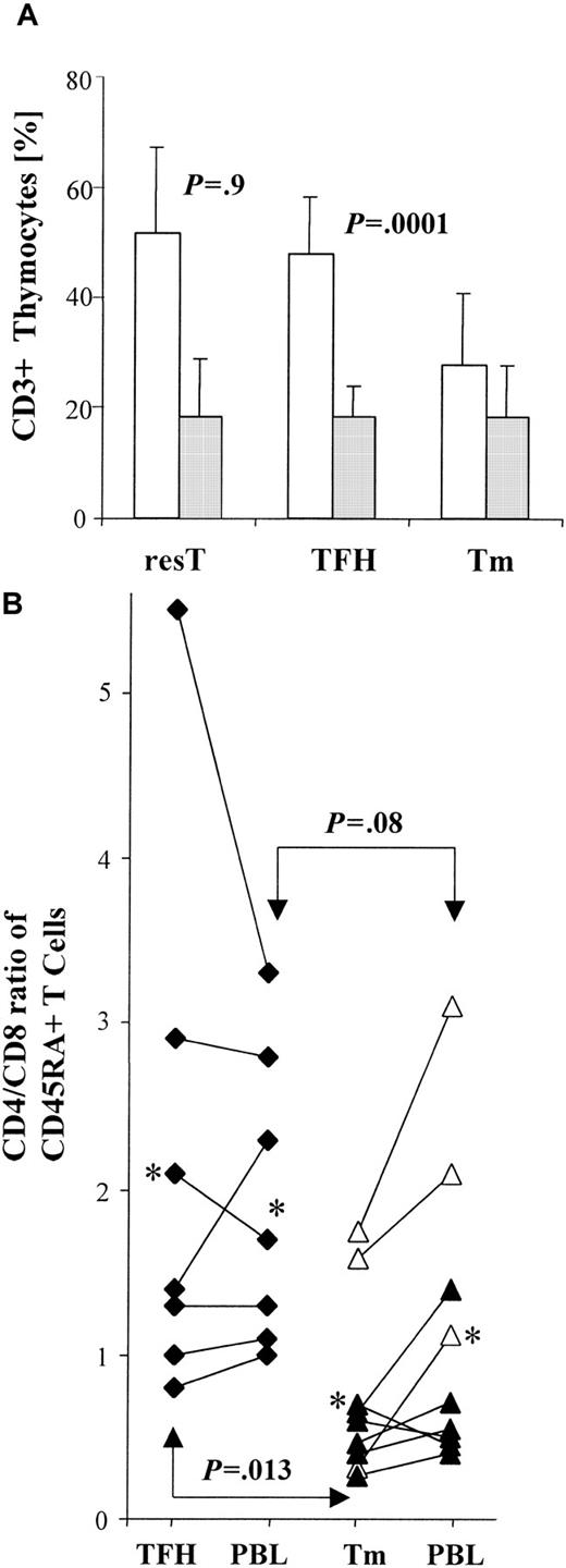 Fig. 3. The CD4/CD8 ratio is decreased in thymoma. / (A) Bar graph shows the mean percentages of mature CD4+(■) and CD8+ (░) thymocytes in residual thymus (resT; n = 9), thymus with thymic follicular hyperplasia (TFH; n = 11), and thymoma (Tm; n = 19), as determined by FACS-based analyses gated on CD3+ T cells. Error bars indicate the SE. The percentage of mature CD8+ T cells is similar among nonneoplastic thymuses (resT, TFH) and thymomas (P = .9). The percentage of CD4+ T cells is similar between resT and TFH (P = .9), but significantly lower between nonneoplastic thymuses (resT, TFH) and thymomas (P = .0001). (B) Diagram compares CD4/CD8 ratios among CD45RA+ T cells in individual cases. T cells were derived from thymus and blood (PBL) of TFH patients (n = 7) and from thymoma (Tm) and PBL of thymoma patients (n = 9). The proportion of CD4/CD8 CD45RA+ T cells was calculated for thymocytes and PBL from each patient, using FACS-based analyses gated on CD3+ T cells. Each asterisk represents the mean ratio among either TFH or Tm and corresponding PBL, respectively. CD4/CD8 ratios of thymoma-derived CD45RA+ T cells were significantly decreased (P = .013) when compared with those of thymocytes from patients with TFH. CD4/CD8 ratios among CD45RA+ PBL were also decreased in thymoma patients compared with TFH patients, although this represented only a trend (P = .08). In patients with thymoma, CD4/CD8 ratios were elevated (P = .07) among circulating CD45RA+ T cells compared with thymocytes, whereas CD4/CD8 ratios were almost identical among CD45RA+ T cells in the periphery and thymus of TFH patients (P = .83). ▵, Tm/MG+; ▴, Tm/MG −; ♦, TFH/MG+.