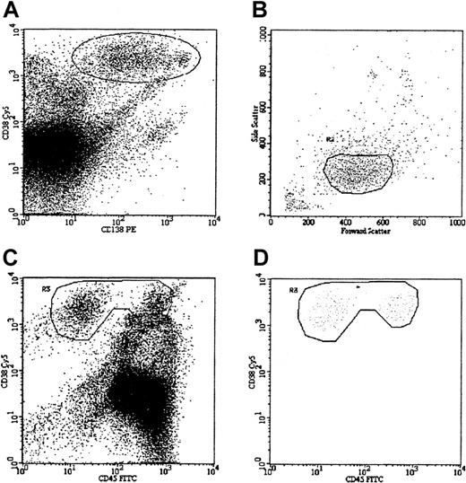 Fig. 1. Sequential gating strategy for identification of plasma cells. / The gating strategy is demonstrated in a patient with MGUS, with approximately even numbers of normal and myeloma plasma cells. (A) Plot showing all cells, with CD138 (Syndecan-1, B-B4) expression against CD38 expression. High CD138 and CD38 expression (region 1) usually provides the best separation of bone marrow plasma cells from other leukocytes, but also contains a significant proportion of cells binding antibodies nonspecifically (the diagonal line of dots). Contaminating cells can be removed in most cases using a region set on forward- and side-scatter characteristics. (B) Scatter characteristics of cells identified in region 1 (R1). Plasma cell scatter characteristics vary from patient to patient, in keeping with their morphologic heterogeneity. However, by excluding cells with very low or very high forward- and light-scatter characteristics (apoptotic cells or debris and doublets or electronic noise, respectively), it is possible in most cases to exclude the majority of contaminating events. (C) Plot showing all cells, with CD38 against CD45 expression. The neoplastic plasma cells are clearly visible as a distinct population in the upper left area of the plot; however, the normal plasma cells in the upper right are not a discrete population and overlap with other leukocytes as well as nonspecific binding events. The contaminating leukocyte population is, in this case, normal B-cell progenitor cells, which are often more numerous in MGUS patients than plasma cells. Activated T cells expressing the same level of CD38 as plasma cells are also common in myeloma. (D) The same plot as (C), but the only cells displayed are those satisfying the scatter region (R2), indicating that 2 clear populations are present with no obvious contamination. The rationale for using CD38 versus CD45, as opposed to CD138 versus CD38, as the primary phenotypic gate has been reported previously,29but is, briefly, because of the following: (1) an immunophenotypic gate set on dual positivity is more likely to contain contamination than a gate set on the basis of one positive and one negative marker because a cell that binds one antibody nonspecifically also binds others, and hence is more likely to contaminate a dual-positive region; and (2) CD138 is expressed at a significantly lower level by circulating plasma cells than by paired marrow counterparts, whereas CD38/CD45 expression does not vary and therefore provides a more consistent approach for all samples. Internal controls to ensure that plasma cells have been accurately identified are shown in Figure 2.
