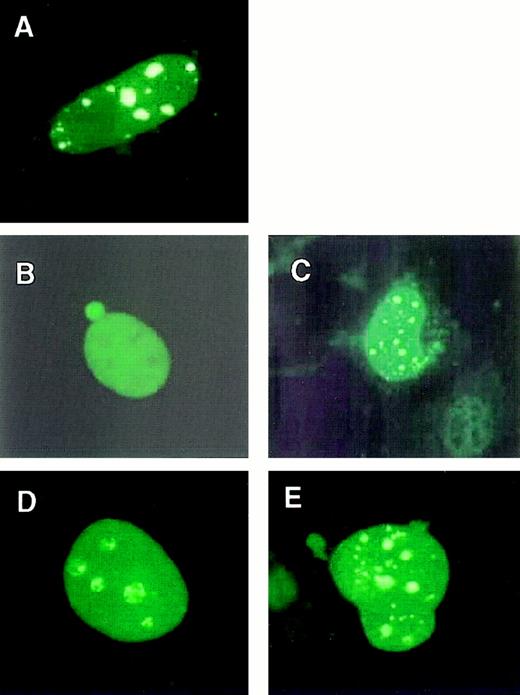 Fig. 3. Subnuclear localizations of MLL-ELL and wild-type ELL. / Mouse embryo fibroblasts were transfected with FLAG-tagged MLL (A), wild-type ELL (B), MLL-ELL (C), MLL-ELLΔ150-200 (D), or MLL-ELLΔ374-620 (E). Transfected mouse embryo fibroblasts were stained with a FLAG-specific mAb (A) to detect wild-type MLL or an ELL-specific mAb (B-E) to detect wild-type and chimeric ELL proteins. ELL exhibited a diffuse pattern, whereas ELL fusion proteins were distributed in a punctate and diffuse pattern indistinguishable from that of wild-type MLL.