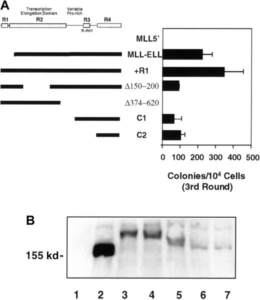 Fig. 6. Identification of ELL sequences required for immortalization of primary murine myeloid progenitors. / (A) Thick lines under the schematic of ELL indicate sequences fused to MLL5′; horizontal bars indicate the number of colonies generated per 104 cells plated in third-round cultures. Bars represent the mean ± SD of 3 independent experiments. Retroviral transduction efficiency for the various constructs was 60% (MLL-5′), 39% (MLL-ELL), 34% (+R1), 33% (Δ150-200), 29% (Δ374-620), 27% (C1), and 43% (C2). (B) Western blot analysis of fusion protein expression in transiently transfected φNX cells. Lane 1, MSCV vector; lane 2, MLL5′; lane 3, MLL-ELL; lane 4, MLL-ELLΔ150-200; lane 5, MLL-ELLΔ374-620; lane 6, MLL-ELLC1; lane 7, MLL-ELLC2.