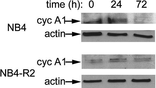 Fig. 5. Reduction of cyclin A1 protein levels by ATRA in NB4 cells but not in ATRA-resistant NB4-R2 cells. / Immunoblot analysis showing cyclin A1 protein levels in NB4 cells at 0, 24, and 72 hours of exposure to ATRA (10−6 mol/L). On each lane, 20 μg total protein was loaded. An anti-actin antibody was used to demonstrate equal loading.