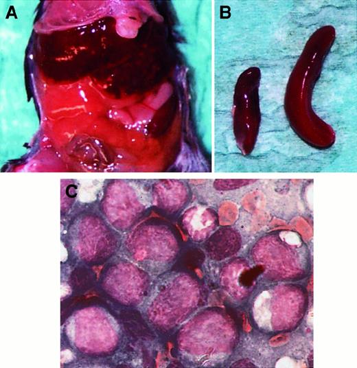 Fig. 5. Development of leukemia-like disease in 32D/Flt3-ITD–injected mice. / Female C3H/HeJ mice, aged 8 to 10 weeks, were used for the in vivo tumorigenesis experiments. The 1 × 106 cells were inoculated intravenously. The figure shows an animal at autopsy 28 days after injection of 32D cells containing ITD2. (A) The abdomen of the mouse showing a grossly enlarged liver. (B) The explanted spleen (right) is shown; for size comparison, the spleen of an uninjected animal (left) was photographed simultaneously. (C) Bone marrow smear, Pappenheim stain.