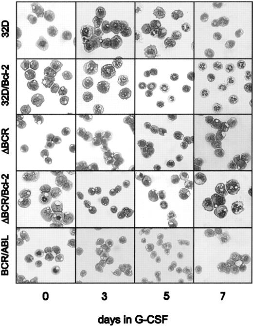 Fig. 3. G-CSF–induced differentiation of parental and transfected 32Dc13 cells. / Representative microphotographs of May-Grünwald-Giemsa–stained cytospins.