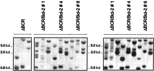 Fig. 7. Southern blot analysis of the Bcl-2 locus in p185ΔBCR/Bcl-2 clones before injection in SCID mice and in leukemic cells recovered from the spleen. / Southern blot of genomic DNA from p185ΔBCR 32Dc13 clones (left panel), p185ΔBCR/Bcl-2 clones (middle panel), and p185ΔBCR/Bcl-2 clones recovered from the spleen of leukemic mice (right panel). Genomic DNA was digested with HindIII, BamHI, orXbaI (from left to right), electrophoresed on a 0.8% agarose gel, transferred to nylon membranes, and hybridized to a32P-labeled Bcl-2 fragment.