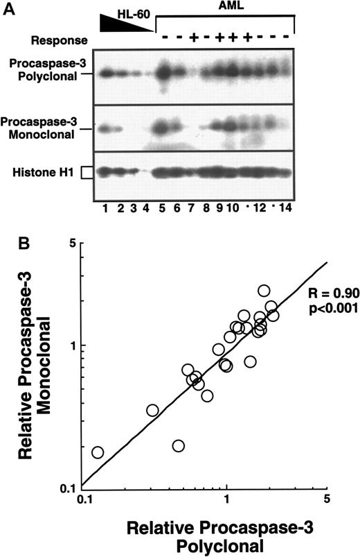 Fig. 3. Evaluation of the reproducibility of caspase quantitation by immunoblotting. / Duplicate blots containing AML samples and a serial dilution of HL-60 cells were prepared as described in the legend to Figure 2. (A) Results obtained when one pair of blots was probed with affinity-purified polyclonal rabbit anticaspase-3 antiserum (top) or monoclonal anticaspase-3 antibody (middle). Histone H1 (bottom) served as a loading control. Responses to therapy are indicated as described in the legend to Figure 2. (B) The blots shown in panel A, along with an additional pair of blots, were probed with both caspase-3 reagents, scanned, and quantitated as described in the “Materials and methods.” A value of 1.0 indicates that a particular leukemia sample contained as much procaspase-3 as an equal number of HL-60 cells after correction for loading by normalization of histone H1 contents.