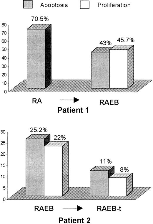 Fig. 3. Sequential analysis of CD34+ cell apoptosis and proliferation during MDS progression. / Bone marrow CD34+ cell apoptosis and proliferation, using annexin V and Ki-67 labeling, respectively, was evaluated sequentially in 2 patients undergoing MDS evolution. BM blast percentage in patient 1 increased from 3% to 9% non-erythroid cells, whereas, in the second case, transformation from RAEB to RAEB-t was accompanied by karyotypic evolution.