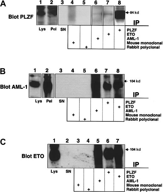 Fig. 2. Interaction of endogenous PLZF and AML-1/ETO in a t(8;21) M2 leukemia cell line. / SKNO-1 cells were lysed and subjected to immunoprecipitation–immunoblot analysis. (A) Immunoblot with PLZF mouse monoclonal antibody. Lane 1, direct immunoblot of SKNO-1 cell lysate. Lane 2, blot of immunopellet. Lane 3, lysate supernatant after immunoprecipitation. Lanes 4-8, extracts immunoprecipitated with mouse control antibody, rabbit control antibody, AML-1 antibody, ETO antibody, and PLZF antibody. (B) Immunoblot with AML-1 rabbit polyclonal antibody. Lane 1, direct immunoblot of SKNO-1 cell lysate. Lane 2, blot of immunopellet. Lane 3, lysate supernatant after immunoprecipitation. Lanes 4-8, extracts immunoprecipitated with mouse control antibody, rabbit control antibody, AML-1 antibody, PLZF antibody, and ETO antibody. (C) Immunoblot with ETO rabbit polyclonal antibody. Lane 1, direct immunoblot of SKNO-1 cell lysate. Lane 2, lysate supernatant after immunopelleting. Lanes 3-7, extracts immunoprecipitated with mouse control antibody, rabbit control antibody, AML-1 antibody, PLZF antibody, and ETO antibody.