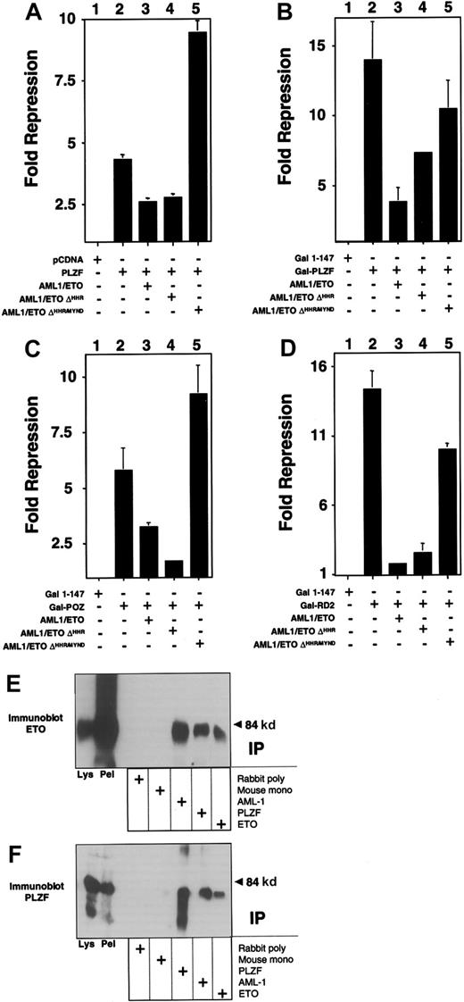 Fig. 5. The AML-1/ETO C-terminal corepressor binding domains are required to block PLZF repression. / Transient transfections and reporter assays performed in 293T cells in 12-well dishes. Results are all depicted as fold repression relative to the control plasmid basal expression level. (A) Experiments performed with the IL-3Rα chain reporter. Lane 1, pCDNA 400 ng. Lane 2, PLZF 400 ng. Lane 3, PLZF 400 ng plus AML-1/ETO 300 ng. Lane 4, PLZF 400 ng plus AML-1/ETOΔHHR 300 ng. Lane 5, PLZF 400 ng plus AML-1/ETOΔHHR/MYND 300 ng. (B-D) Experiments performed with the (GAL4)5-tk-Luc reporter and GAL4-PLZF in B, GAL4-BTB/POZ in C, and GAL4-RD2 in D. Doses are identical to those in A. Results of all graphs reflect the average of multiple experiments ± SEM. (E,F) 293T cells were transfected with 750 ng each of pCMV-AML-1/ETOΔHHR/MYND and pCDNA-PLZF expression vectors. Cells were lysed and subjected to immunoprecipitations and immunoblotting as indicated. (E) Immunoblot with ETO C-terminal rabbit polyclonal antibody. (F) Immunoblot with PLZF mouse monoclonal antibody. Lanes 1 and 2 of both panels correspond to immunoblots of cell lysates and precipitated pellet, respectively. Lanes 3 to 7 correspond to immunoprecipitates as indicated.