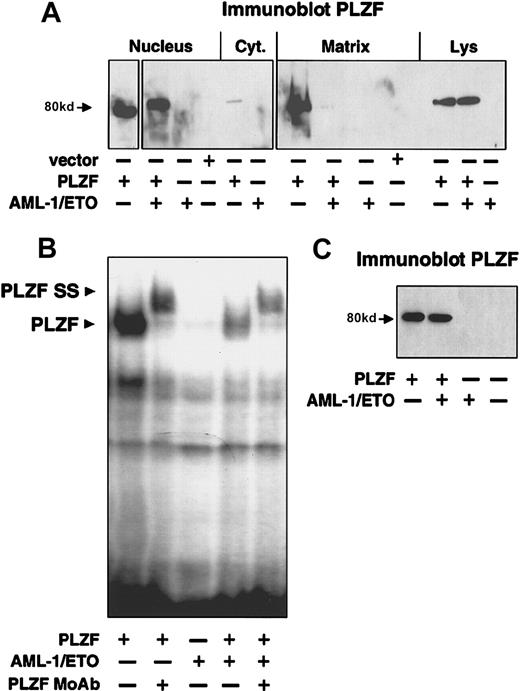 Fig. 7. AML-1/ETO disrupts nuclear matrix compartmentalization of PLZF and reduces its ability to bind to DNA. / (A) 200 ng vector, PLZF, AML-1/ETO, or PLZF plus AML-1/ETO was transfected in 293T cells. The cells were fractionated into cytoplasmic, nuclear, and nuclear matrix fractions. Immunoblotting with PLZF monoclonal antibodies was performed on each fraction and on the unfractionated whole cell lysates. (B) EMSA was performed on lysates from transfected 293T cells. Expression vectors in each transfection are indicated. The PLZF high-molecular–weight complex is indicated by the lower arrowhead, and the supershift generated by the addition of anti-PLZF monoclonal antibodies is indicated by the upper arrowhead. (C) Immunoblot of lysates from the cells used in the EMSA in B after normalization for protein concentration.