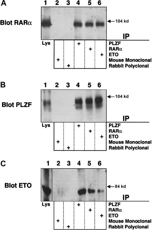 Fig. 8. PLZF/RARα interacts with ETO. PLZF/RARα and ETO (750 ng) were both transiently transfected in 293T cells grown in 6-well dishes. / Cells were lysed and subjected to immunoprecipitations and immunoblotting. (A) Immunoblot with RARα rabbit polyclonal antibody. (B) Immunoblot with PLZF mouse monoclonal antibody. (C) Immunoblot with ETO rabbit polyclonal antibody. The lanes of all 3 panels correspond to similar experiments. Lane 1, direct immunoblot of cell lysate. Lanes 2-6, extracts immunoprecipitated with mouse control antibody, rabbit control antibody, PLZF antibody, RARα antibody, and ETO antibody, respectively.