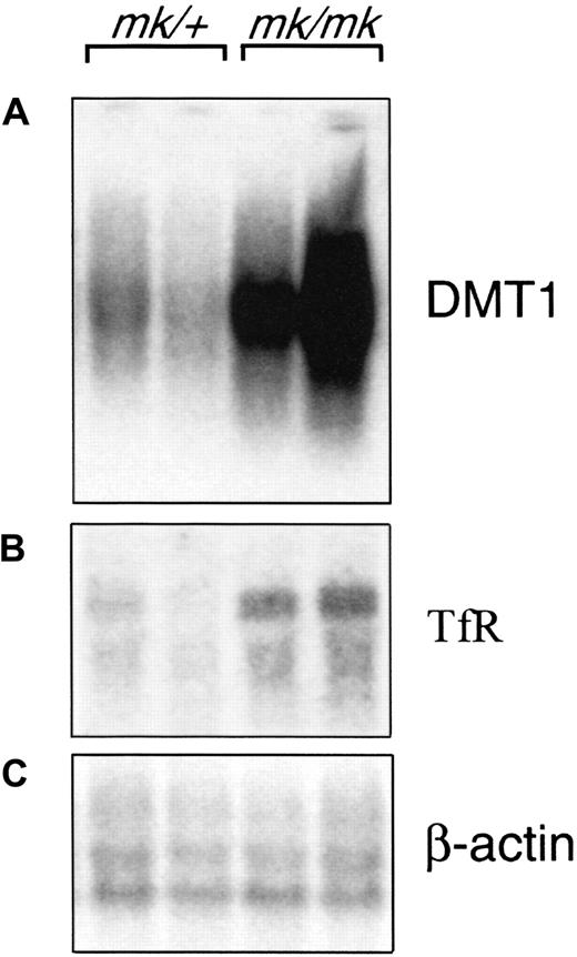 Fig. 1. DMT1 mRNA expression in intestine from anemicmk/mk mice. / The proximal portion of the small intestine immediately adjacent to the stomach was dissected from mk/+ heterozygotes andmk/mk homozygous anemic mice (2 animals in each group). Total RNA from each tissue was prepared, separated by electrophoresis through a denaturing agarose gel, and followed by blotting to a hybridization membrane. The blot was probed with a DMT1 cDNA probe that recognizes both the IRE (isoform I) and non-IRE (isoform II) containing mRNAs (A) and was washed under highly stringent conditions. After removal of the probe, the blot was sequentially rehybridized with probes for TfR (B) and β-actin (C).