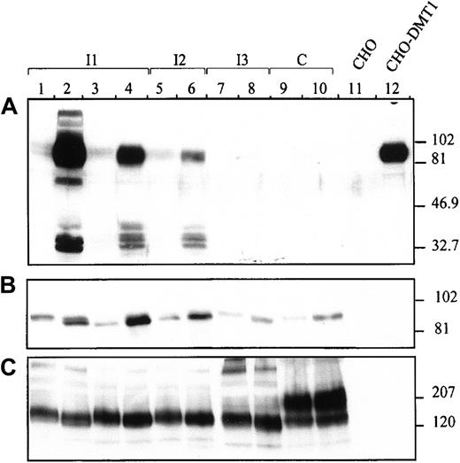 Fig. 2. Expression of DMT1 protein in the gastrointestinal tract of anemic mk/mk mice. / Proximal (I1) and distal (I2) sections of the duodenum as well as ileum (I3) and colon (C) were harvested from heterozygous mk/+(lanes 3, 5, 7, and 9) or homozygous mk/mk mice (lanes 4, 6, 8, and 10). Microsomal fractions were prepared as previously described11 and 80 μg samples of membrane proteins were resolved on a 10% acrylamide gel and transferred to a polyvinylidene fluoride membrane. For comparison, microsomal fractions isolated from proximal duodenum (I1) of wild type mice (+/+) fed a normal diet (lane 1) or a low-iron diet (lane 2) were included in the analysis. To demonstrate the specificity of the anti-DMT1 antibody, 5 μg of membrane proteins from CHO cells (lane 11) or CHO cells expressing cMyc-tagged DMT1 isoform II (lane 12) were also included. Immunoblotting was performed with antibodies raised against the amino terminus of DMT1 (DMT1-NT) (A), the transferrin receptor (B), and Bgp1 proteins (C). The positions and sizes (in kilodaltons) of molecular mass markers are indicated on the right.
