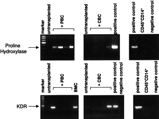 Fig. 3. RT-PCR amplification of RNA from mice. / RNA was isolated from the bone marrow or spleen cell suspensions of transplanted or nontransplanted mice as indicated. The cDNA was prepared and analyzed for the presence of transcripts for human KDR or human proline hydroxylase as described in “Patients, materials, and methods.” The PCR products were separated on agarose gels and visualized with ethidium bromide. Negative control, mock PCR using water instead of cDNA; positive control, cDNA from human umbilical vein endothelial cells (HUVECs) for KDR, or KMST-6 fibroblasts of human Dexter cultures for proline hydroxylase. CD45+CD14+: analysis of sorted cells from Dexter cultures as described in “Patients, materials, and methods.” A total of 3 of 9 transplanted mice were positive for human KDR cDNA and 6 of 8 mice for proline hydroxylase. BMC indicates analysis from a bone marrow culture established from the bone marrow of a mouse transplanted with CD34+ PBCs.