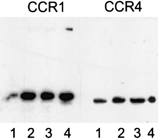 Fig. 3. Expression of CCR1 and CCR4 in platelets assessed by immunoprecipitation and immunoblotting using antipeptide polyclonal antibodies. / Left panel, detection with anti-CCR1 polyclonal antibodies; 1, platelet lysate; 2, immunoprecipitate from platelets of donor A with anti-CCR1 polyclonal antibodies; 3, immunoprecipitate from platelets of donor B with anti-CCR1 polyclonal antibodies; 4, immunoprecipitate from monocytes with anti-CCR1 polyclonal antibodies. Right panel, detection with anti-CCR4 polyclonal antibodies; 1, platelet lysate; 2, immunoprecipitate from platelets of donor A with anti-CCR4 polyclonal antibodies; 3, immunoprecipitate from platelets of donor B with anti-CCR4 polyclonal antibodies; 4, immunoprecipitate from CCR4 transfected cells with anti-CCR4 polyclonal antibodies.