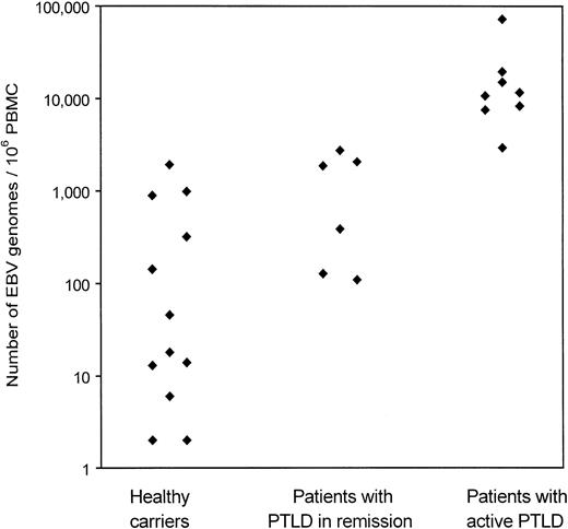 Fig. 2. Copy number of EBV genomes in peripheral blood of healthy carriers, patients with PTLD in remission, and patients with active PTLD. / DNA from 1 × 106 PBMCs spiked with 200 copies of ICS was isolated and eluted into 100 μL dH2O. For QC-PCR, 40 μL DNA was used and the EBV load measured and calculated as described in Figure 1. EBV loads in healthy carriers are the average of 6 separate experiments. DNA was isolated independently for each of these experiments.