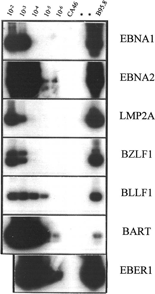 Fig. 6. Sensitivity of oligonucleotide primer-probe combinations used in RT-PCR analysis. / RT-PCR was performed on RNA extracted from mixtures of EBV− CA46 cells and serial 10-fold dilutions (10−2 to 10−6) of the virus-productive B95.8 cells. In the case of EBNA1, Rael cells were used instead of B95.8 cells. RNA was extracted from a total of 20 × 106 cells, and a fraction corresponding to 2 × 106 cells was used for each RT-PCR followed by Southern hybridization.