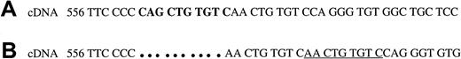 Fig. 1. The normal sequence of exon 5 of the transferrin gene and the rearrangement found in the patient with atransferrinemia. / Comparison of the normal sequence of exon 5 of the transferrin gene (A) and the rearrangement found in the patient with atransferrinemia (B). The 10-bp sequence that is deleted from the mutant gene, cDNA 562-571, is shown in bold in the normal sequence. The 9-bp duplication that has been inserted into the mutant gene is underlined. The rearrangement leads to a frameshift and an early termination.