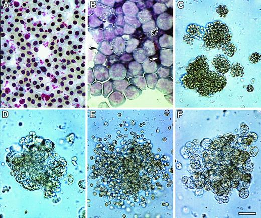 Fig. 1. Colony formation of bone marrow cultures. / HPCs were obtained from ED14 quail embryonic bone marrow by separation on Ficoll-Paque density gradients and subsequent removal of cells adherent to tissue-culture plastic. The enrichment of progenitor cells by these procedures was confirmed by staining of bone marrow cellular isolates with May-Grünwald-Giemsa (MGG) solution either before (A) or following (B) Ficoll-Paque separation. Note that prior to separation, fully differentiated RBCs were the predominant cell type obtained from the bone marrow (A), whereas the Ficoll-Paque gradients allowed for the isolation of cellular populations that were primarily nondifferentiated blasts (arrows) (B). (C-F) HPC-enriched bone marrow cells were incubated in MeC cultures as described in “Materials and methods.” Cultures were incubated for 6 days prior to microscopic imaging. Representative examples of the types of colonies that formed in these cultures are erythroid (C), granulocyte/macrophage (D), granulocyte/erythroid/macrophage (E), and macrophage (F). Scale bar: A, 15 μm; B, 17 μm; C, 40 μm; D, F, 36 μm; E, 48 μm.