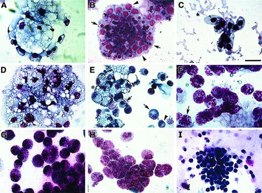 Fig. 3. Blood cell phenotypes exhibited by avian bone marrow. / Bone marrow–derived HPCs were cultured for 6 days in either MeC (A, C, D, E, I) or FB (B, F-H) gels and subsequently stained with MGG solution. Representative cell types that developed from the bone marrow cultures were as follows: clustered vacuolated macrophages surrounded by erythroblasts (A), colony-containing erythroblasts (arrowheads) and developing erythrocytes (arrows) (B), mature RBCs (C), aggregated macrophages (D), mixed areas containing macrophages (asterisk), monocytes (arrows) and heterophils (arrowhead) (E), heterophils (note granules; arrow) (F), basophils (G), eosinophils (H), and thrombocytes (I). All the cell phenotypes shown were equally prevalent in both MeC and FB cultures. Scale bar: A, B, 13 μm; C, H, 8 μm; D, G, I, 14 μm; E, 20 μm; F, 10 μm.