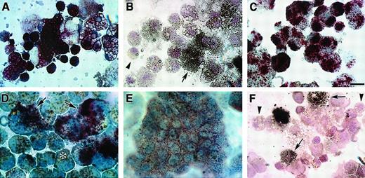 Fig. 5. Enzyme histochemistry of avian bone marrow and QCE6 cells. / MeC cultures of either quail bone marrow HPCs (A-B) or QCE6 cells (C-F) were cultured for 6 days, cytospun onto microscope slides, and assayed for leukocyte-associated enzyme activities. Representative staining for quail bone marrow cultures is shown for both AP (A) and NaF-resistant ANAE (B) activities. (A) All bone marrow–derived leukocytes were AP positive (reddish brown stain). (B) NaF pretreatment of bone marrow cultures distinguished macrophages, which remained ANAE positive (arrow), and the now ANAE-negative monocytes (arrowhead). (C) Similarly to bone marrow cells, all leukocytes that developed from QCE6 cells exhibited positive AP activity (reddish brown stain). (D) High levels of TARP activity were limited to QCE6-derived macrophage subpopulations (arrows). In contrast, tartaric acid treatment significantly reduced staining of monocytes (asterisk). (E) Naphthol AS-D CAE activity (brown stain) was exhibited by leukocytes of QCE6-cell origin. (F) As was shown in panel B with bone marrow cells, NaF pretreatment of QCE6 cells selectively inhibited ANAE activity to allow macrophages (brown stain; arrows) to be distinguished from unstained monocytes (arrowheads). For all these enzyme activities, the patterns of enzyme distribution were identical within cultures derived from either bone marrow or QCE6 cells. Scale bar: A, C, F, 10 μm; B, 12 μm; D, 5 μm; E, 11 μm.