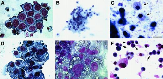 Fig. 8. Blood cell phenotypes exhibited by QCE6 cells in response to altered levels of WNT protein. / WNT11ox/3 (A-C), WNT11αs/4 (D-E), or WNT5a/QCE6 cells (F) were cultured for 6 days in hematopoietic-promoting conditions prior to phenotypic analysis with MGG stain. Panels A and D show cells grown in MeC, and panels B, C, E, and F display cells cultured in FB gels. The prevalent cell phenotypes exhibited by WNT11ox/3 cells were erythroid or monocyte phenotypes, although granulocytes, thrombocytes, and a few macrophages were also observed. An erythroblast cluster (A), an RBC cluster (B), and a high magnification view of RBCs (arrows) (C), which developed from WNT11ox/3 cells. (D-E) In contrast, macrophages were the predominant cell type derived from WNT11αs/4 cells. Monocytes were very rare and RBCs were never observed in cultures of WNT11αs/4 cells. (F) Similarly to WNT11ox/3 cells, stably transfected WNT5a/QCE6 cells contained primarily RBCs (arrows) and monocytes (arrowheads). Scale bar: A, 10 μm; B, 25 μm; C, 6.5 μm; D-F, 12 μm.