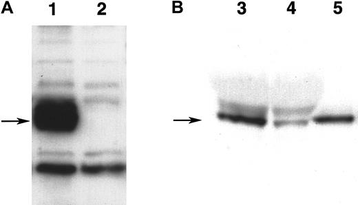 Fig. 9. Detection of WNT5a protein. / (A) Expression of WNT5a protein in stably transfected QCE6 cells. Both lanes contain 25 μg of protein from culture lysates of either stably transfected WNT5a/QCE6 (lane 1) or parental QCE6 cells (lane 2), which were subsequently blotted with antibody reactive to themyc-fusion tag. Arrow indicates the position of an approximately 50-kd band that is present only in the stably transfected cells, which corresponds to the WNT5a fusion protein. (B) Partial purification of WNT5a protein from WNT5a-conditioned media. This shows equal volumes of either nonpurified WNT5a CM (lane 3), the effluent fraction of WNT5a CM run over an Ni-NTA column (lane 4), or the nickel-binding fraction eluted from the same column (lane 5). An arrow indicates the position of an approximately 50-kd WNT5a band that specifically bound to the Ni-NTA column owing to the multiple histidine residues of the fusion protein tag. The protein concentrations of WNT5a CM and Ni-NTA column–purified WNT5a–containing fraction were 14 μg/μL and 52 ng/μL, respectively.