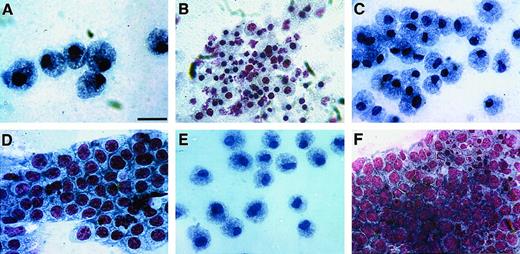 Fig. 10. Effect of WNT11 and WNT5a on expression of blood cell phenotypes. / WNT11 and WNT5a inhibit macrophage formation and promote RBC and monocyte differentiation. WNT11αs/4 cells cultured in the presence of purified WNT5a protein gave rise to predominantly monocytes (A) and RBCs (B). Few macrophages were observed in these cultures. Identical results were obtained when WNT11αs/4 cells were treated with WNT11 CM or WNT5a CM. These results are in complete contrast to the phenotypic profile of WNT11αs/4 cells cultured in the absence of WNT, where macrophages were the predominant cell type, monocytes were infrequently observed, and RBCs were totally absent (see Figure 7, 8). (C-F) Quail bone marrow HPCs also showed increased prevalence of monocytes and RBCs in response to these treatments. Shown here are bone marrow cultures treated with either WNT11 CM (C-D) or purified WNT5a protein (E-F) that produced monocytes (C-E), erythroblasts (D), and developing RBCs (F). Macrophages were infrequently observed in bone marrow cultures in response to either WNT11 or WNT5a. Scale bar: A, D, 10 μm; B-C, 12 μm; E, 13 μm; F, 14 μm.