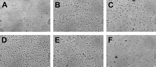 Fig. 4. Adherence of human αIIbβ3+ cells to fibrinogen. / Representative photographs showing adherence of normal human αIIbβ3+ cells to fibrinogen. Cells were not exposed (A) or were exposed (B) to SDF-1, TPO (C), SDF-1 + TPO (D), thrombin (E), or IL-3 (F). Experiment was repeated 3 times in triplicate and yielded similar results.